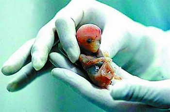42岁成功案例